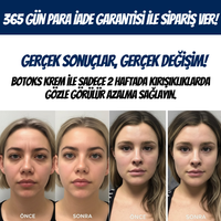 Kırışıklık Karşıtı Botoks Kremi